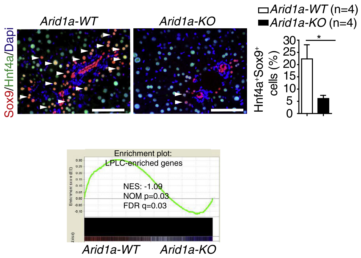 图1 Arid1a-WT/KO小鼠肝损伤诱导LPLCs的差异（上）和LPLC富集基因GSEA分析（下）